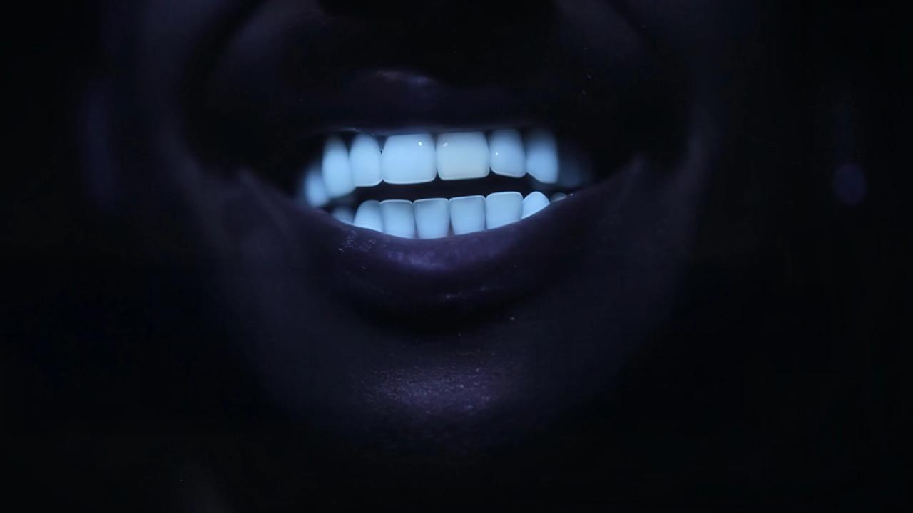 Des dents blanches... au rire jaune ! backdrop