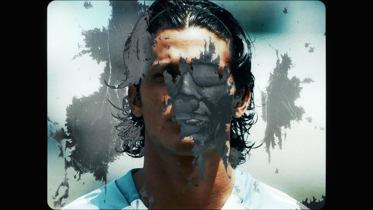 Vitiligo backdrop