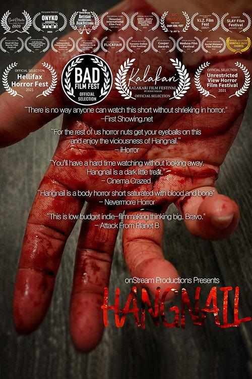 Hangnail backdrop