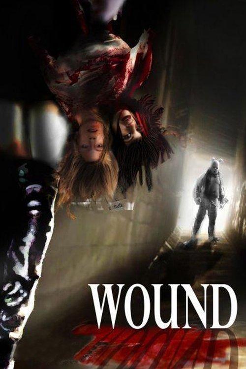 Wound backdrop